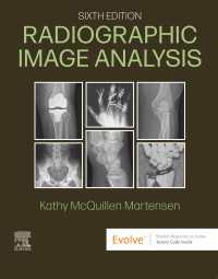 放射線画像分析（第６版）<br>Radiographic Image Analysis - E-Book : Radiographic Image Analysis - E-Book（6）